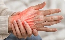 Hand mit entzündeten Gelenken
